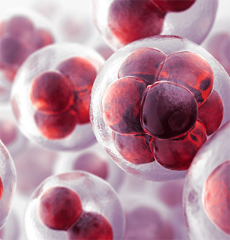 Mechanisms of cancer-associated thrombosis