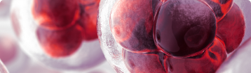 Mechanisms of cancer-associated thrombosis