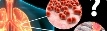 Managing pneumonitis in Immune Checkpoint Inhibitor-treated patients in times of COVID-19