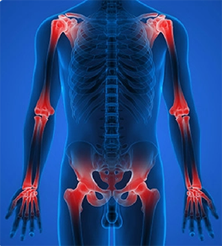 Managing patients with underlying autoimmune disease